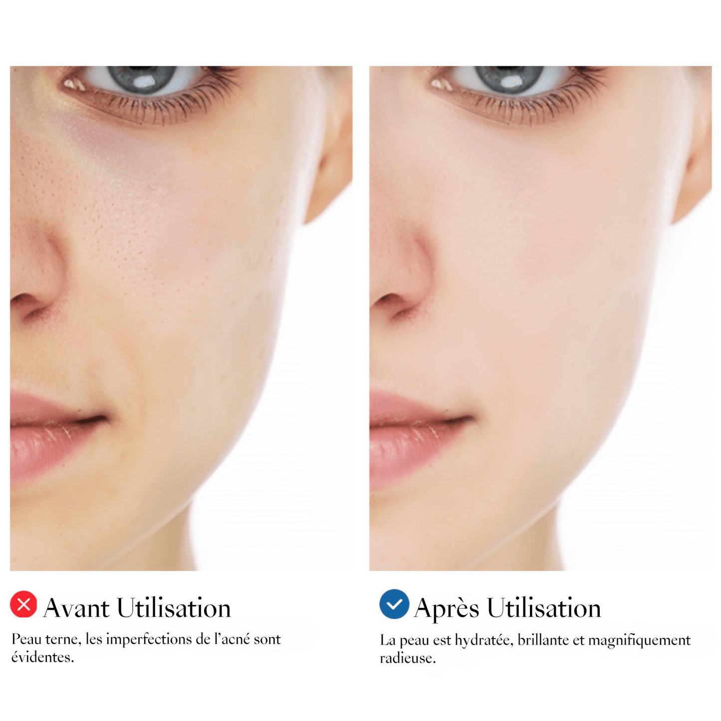 💧Créme Hydradante pour Visage